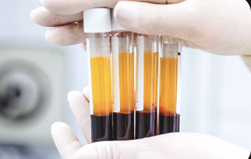 PRP Therapy Tubes